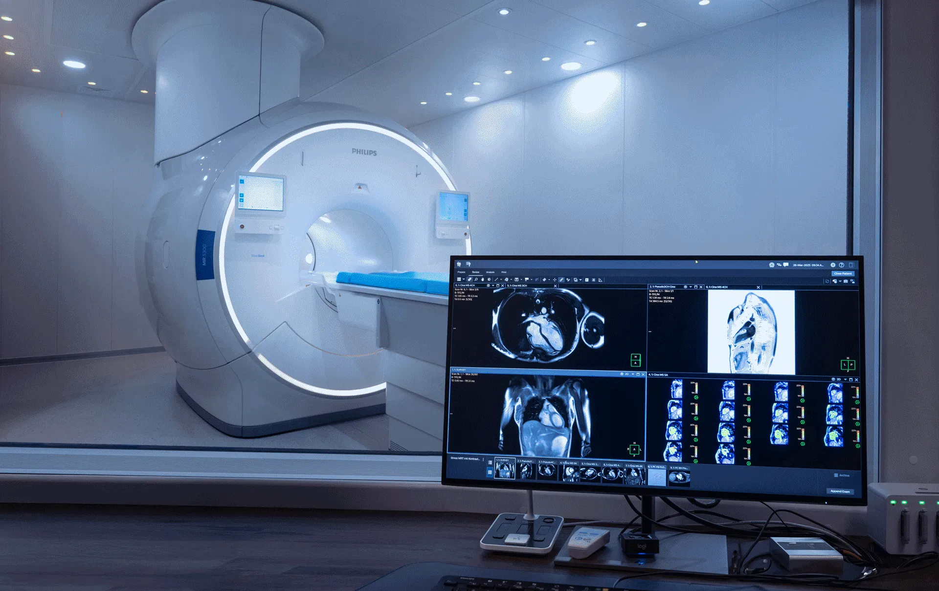 Advanced MRI scanner room at Buff Medical Resort with diagnostic imaging displayed on a monitor.